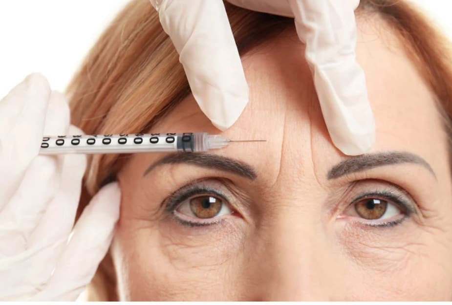 Antiwrinkle injections - 3 areas including a Lip Flip