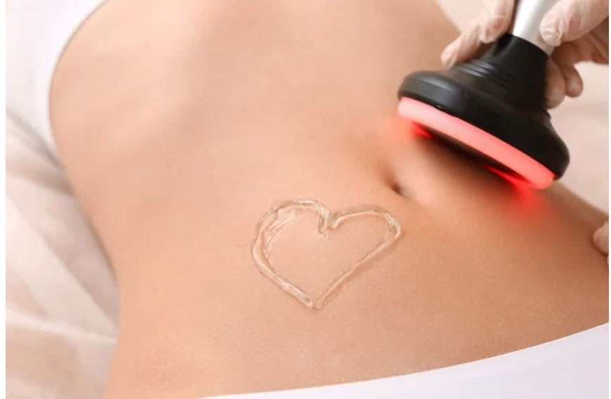 Ultrasound Cavitation - 12 WEEKLY SESSIONS
