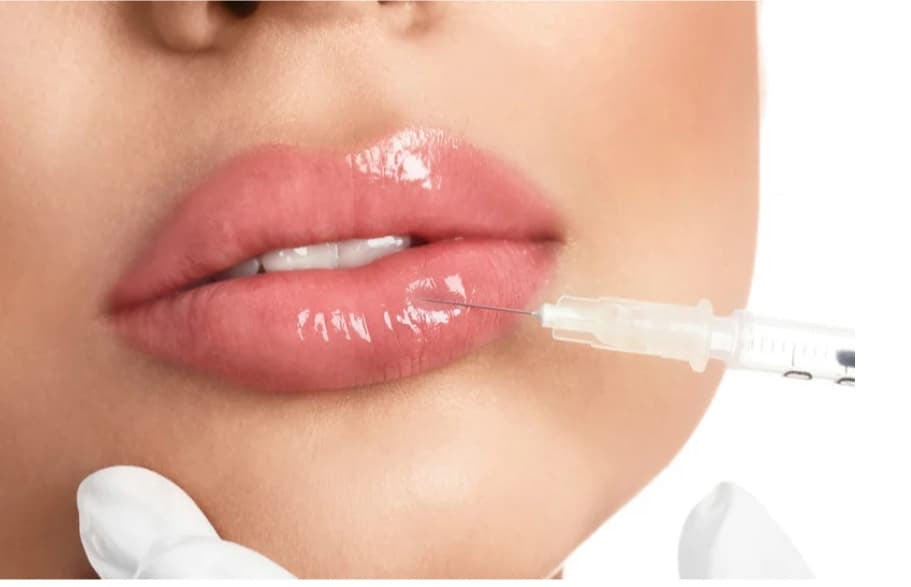 Lip Filler Dissolve and Refill Package