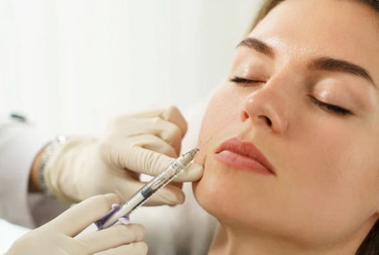 Filler - Nasolabial Fold Augmentation 1.1ML